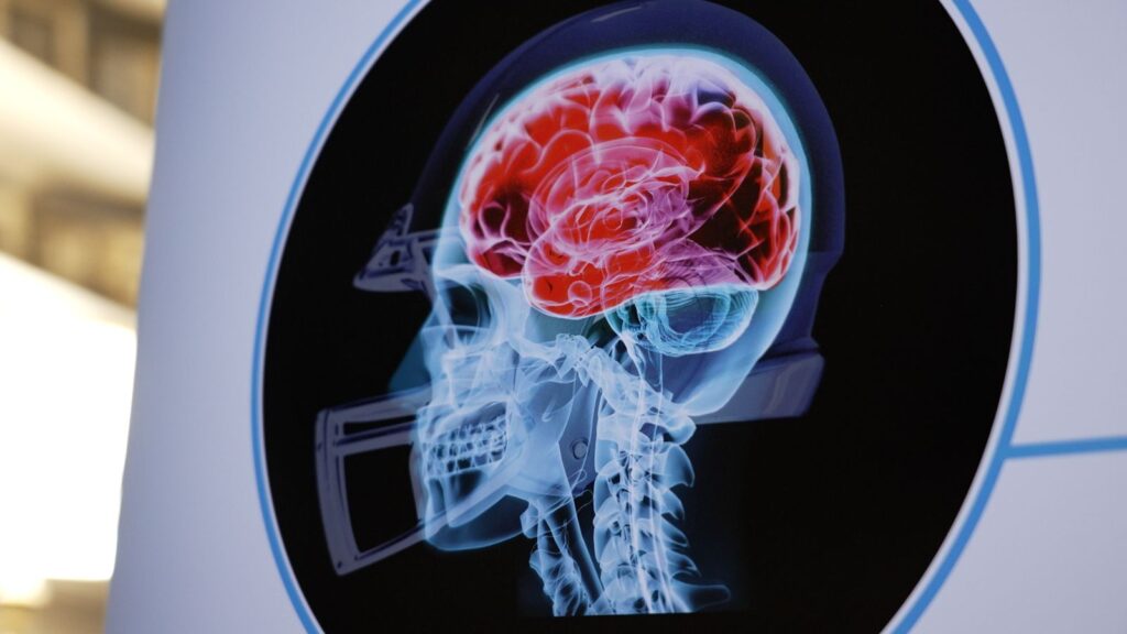 Illnesses related to the effects of sports heads may have “contributed” to “NY mass shootings.”